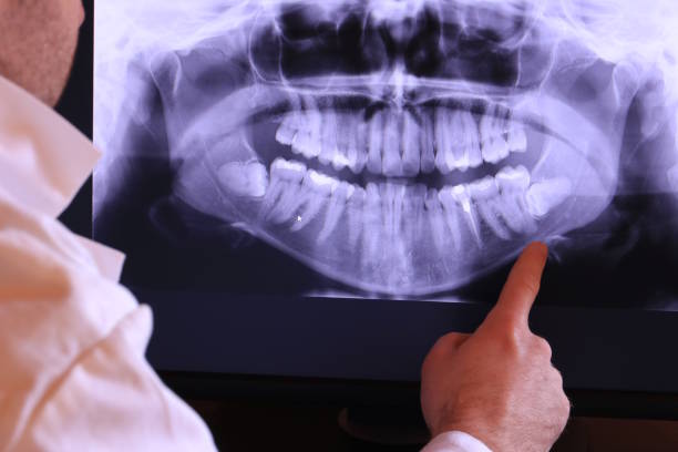 Best Emergency TMJ Treatment in Loma, CO